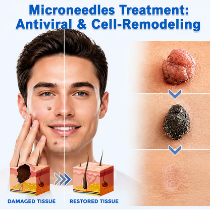 ✨Hiskin ® 2-in-1 Microneedle & Hydrocolloid Patch