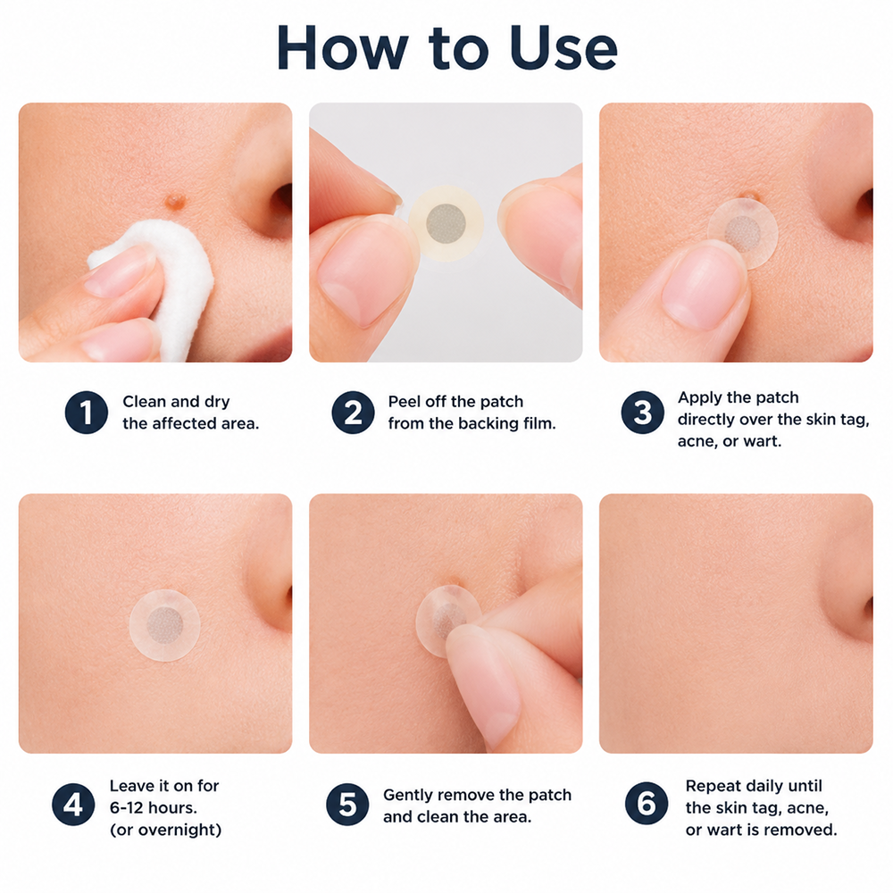 ✨Hiskin ® 2-in-1 Microneedle & Hydrocolloid Patch